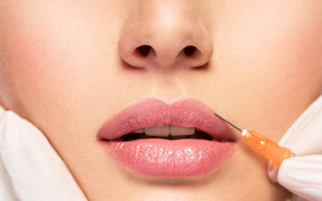 Lip filler : Comment obtenir des lèvres naturelles avec des fillers ?