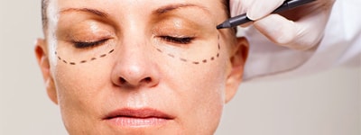 blepharoplastie tunisie