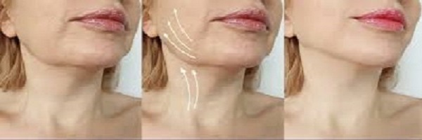 prix d'un lifting du visage