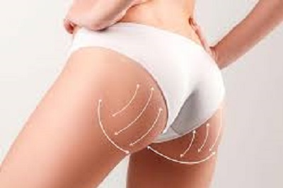 prix d’une augmentation fesses