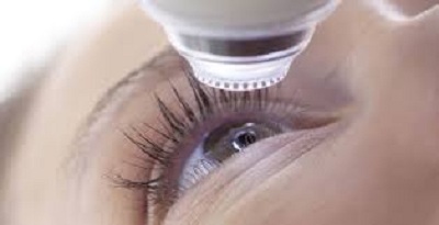 prix d'une operation Lasik