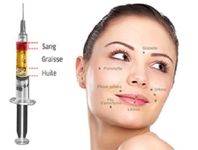 prix d'un lipofilling du visage en tunisie