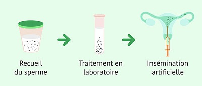 prix insemination artificielle tunisie