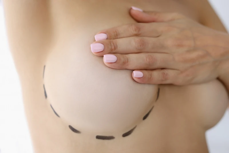 Chirurgie esthétique implant mammaire Tunisie tout compris