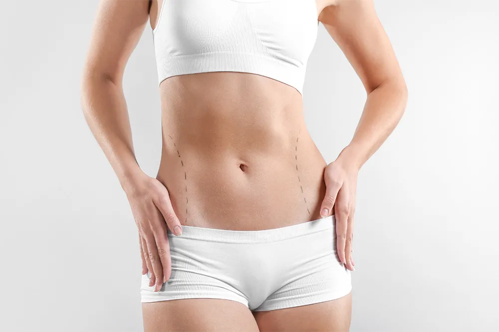 Chirurgie esthétique liposuccion Tunisie prix : Guide & Informations complètes