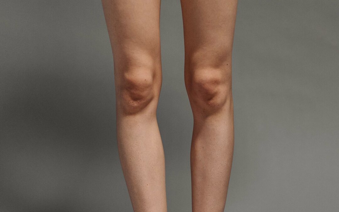 Chirurgie esthétique liposuccion genoux Tunisie prix : Guide des Coûts et Options