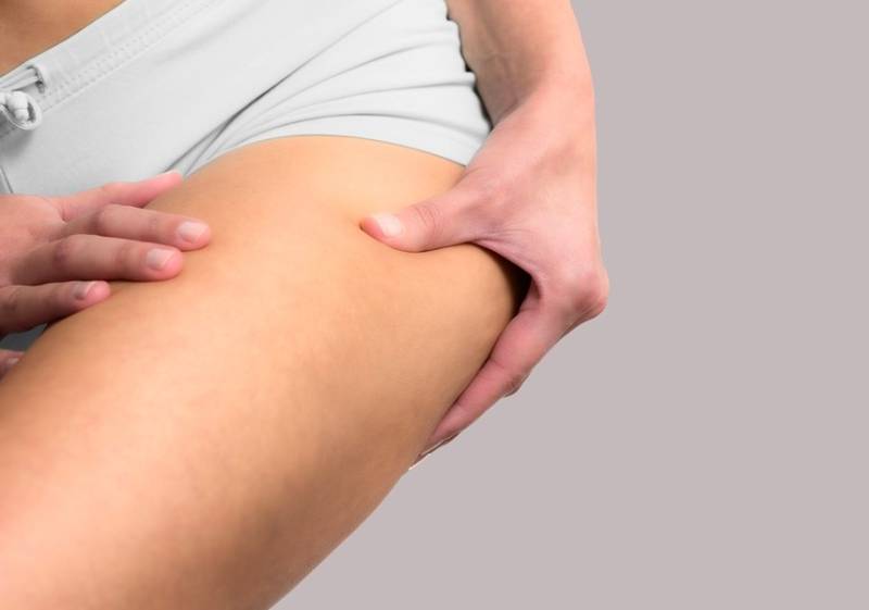 Liposuccion cuisses et culotte de cheval : tout savoir !