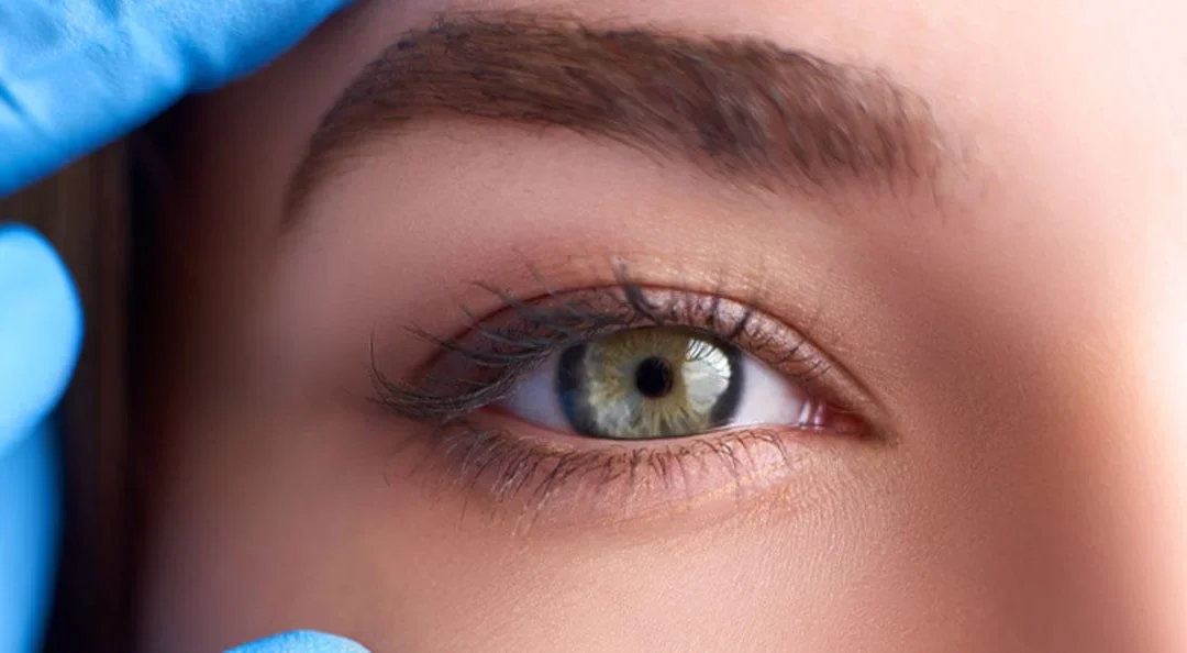 Chirurgie des yeux au laser en Tunisie : Prix & Guide complet