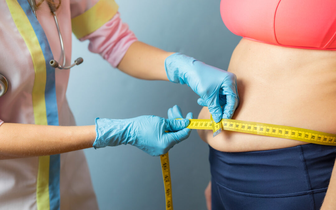 Quel poids faut-il faire pour un anneau gastrique ?