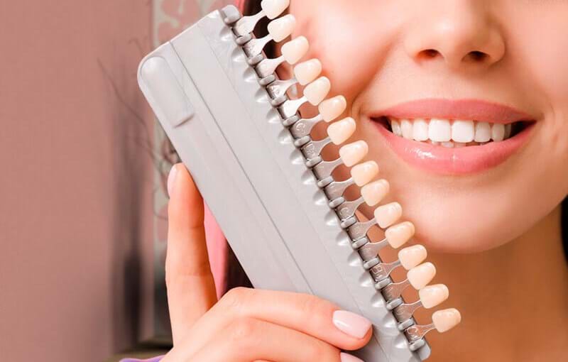Est-il possible de poser des facettes Lumineers sans tailler les dents ?