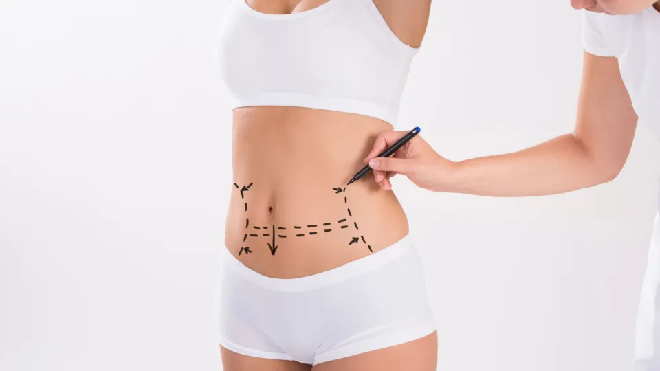 Bodylift Tunisie