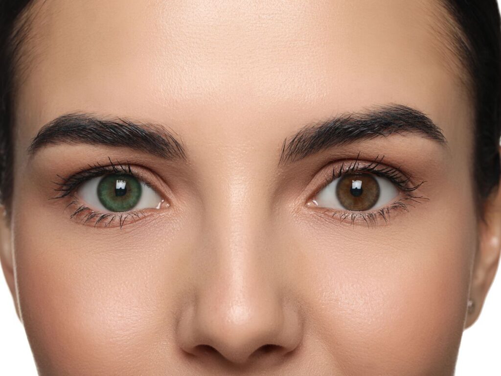 Keratopigmentation Turquie