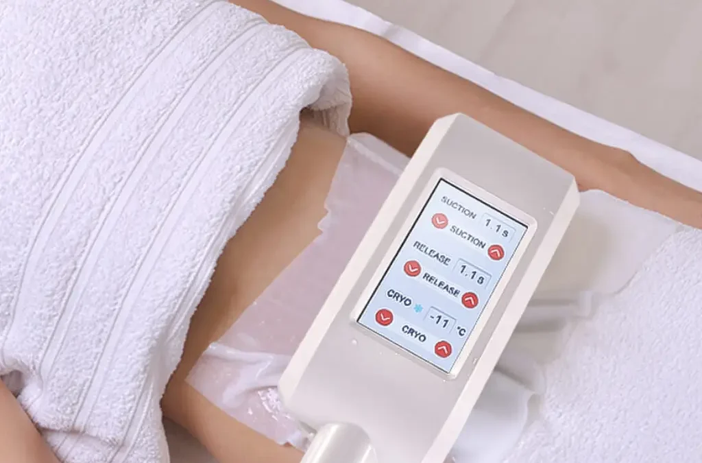 Quelle est la différence entre le CoolSculpting et la cryolipolyse ?
