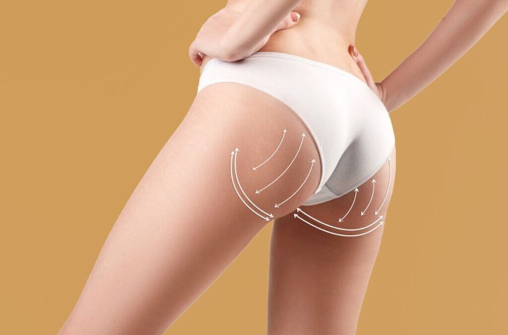 Smart BBL : Augmentation Fesses Sure en Tunisie par Dr GAM