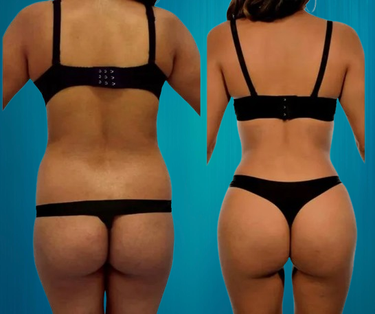 Résultat RibXCar Tunisie