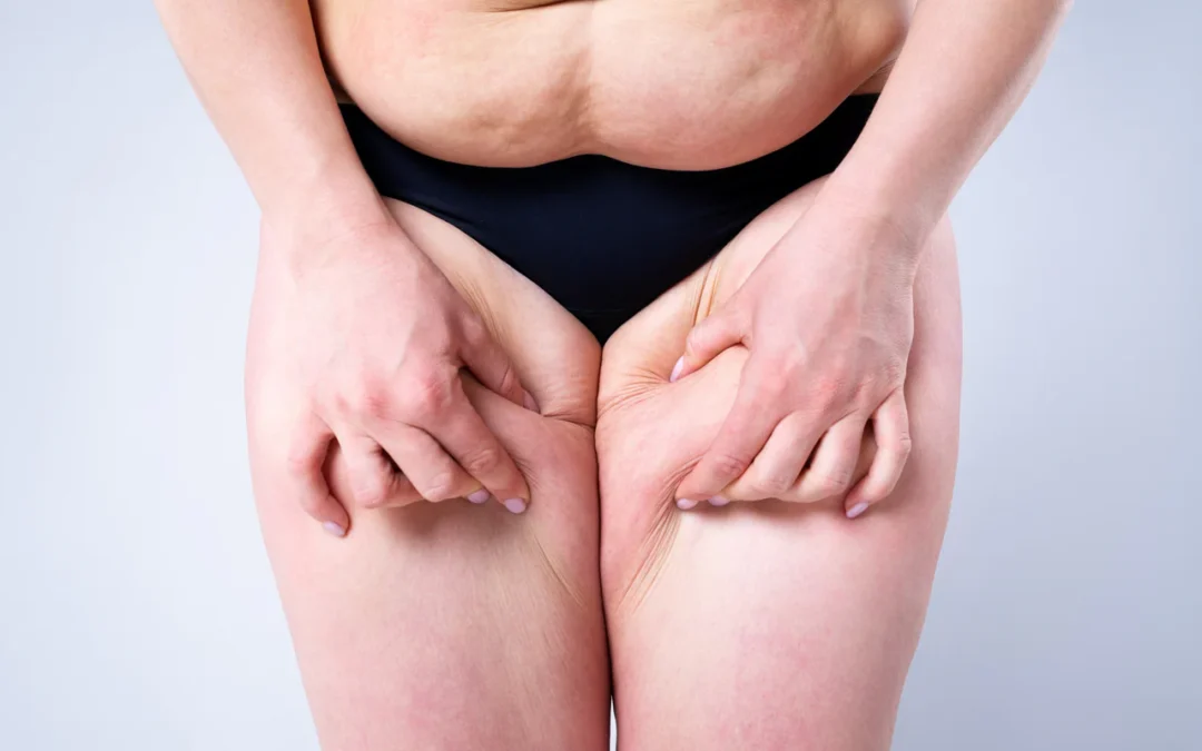 Dr Ramy Ben Salah, expert du lymphœdème : Diagnostic et Traitements spécialisés