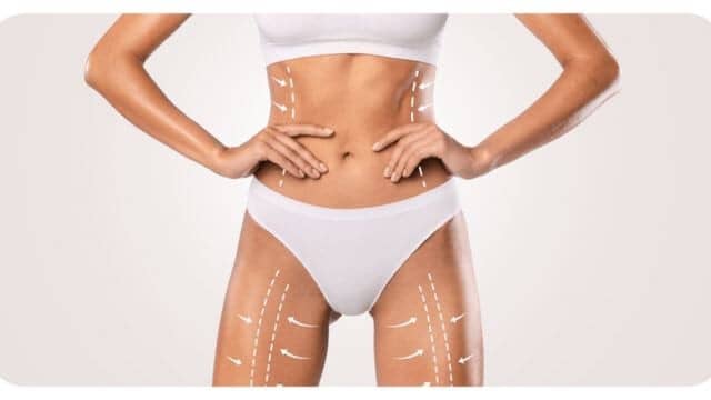 Liposuccion 4D vs liposuccion traditionnelle : quels sont les bénéfices pour le patient ?