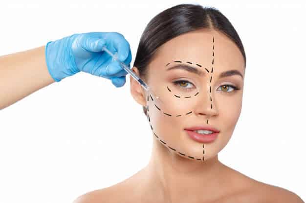 Lipofilling du visage : une solution naturelle pour redonner jeunesse et harmonie au visage