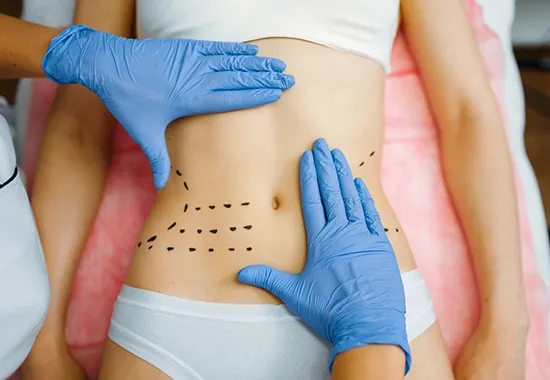 Liposuccion assistée par vibration PAL : une technologie moderne pour une sculpture corporelle précise