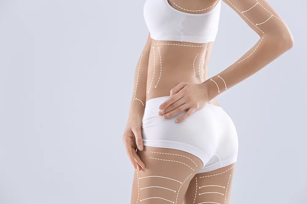 Body contouring après amaigrissement : quelles interventions possibles ?